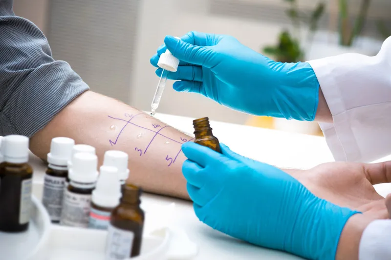 Alergia e Imunologia