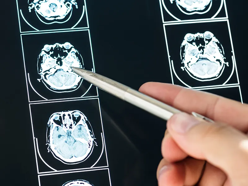 Neuroendocrinologia