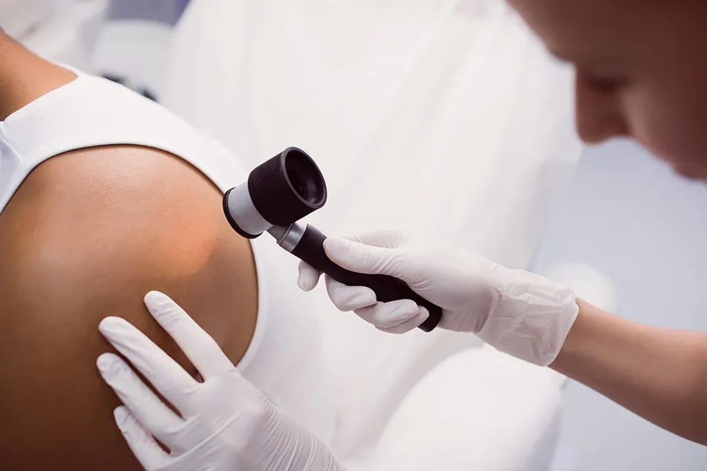 Pós de enfermagem dermatológica