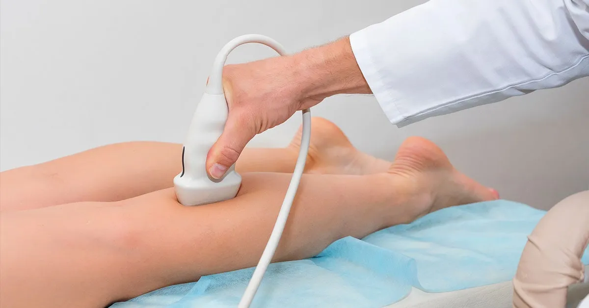 Ultrassonografia Vascular com Doppler
