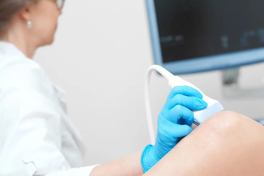 Ultrassonografia Vascular com Doppler