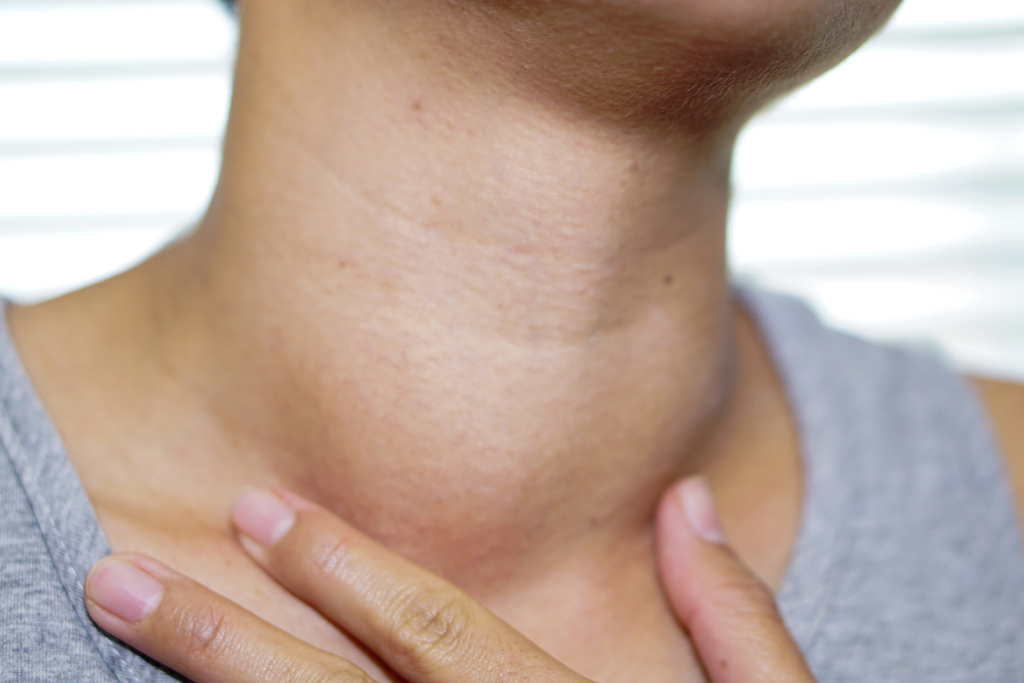 Nódulos da tireoide